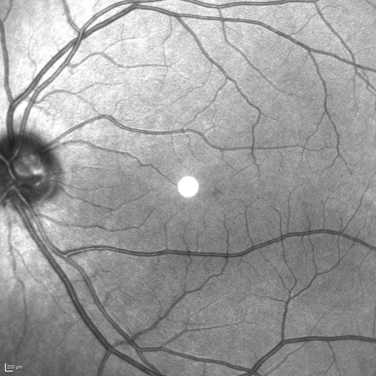 OCT imaging display combining a retinal cross-section with an en-face fundus view