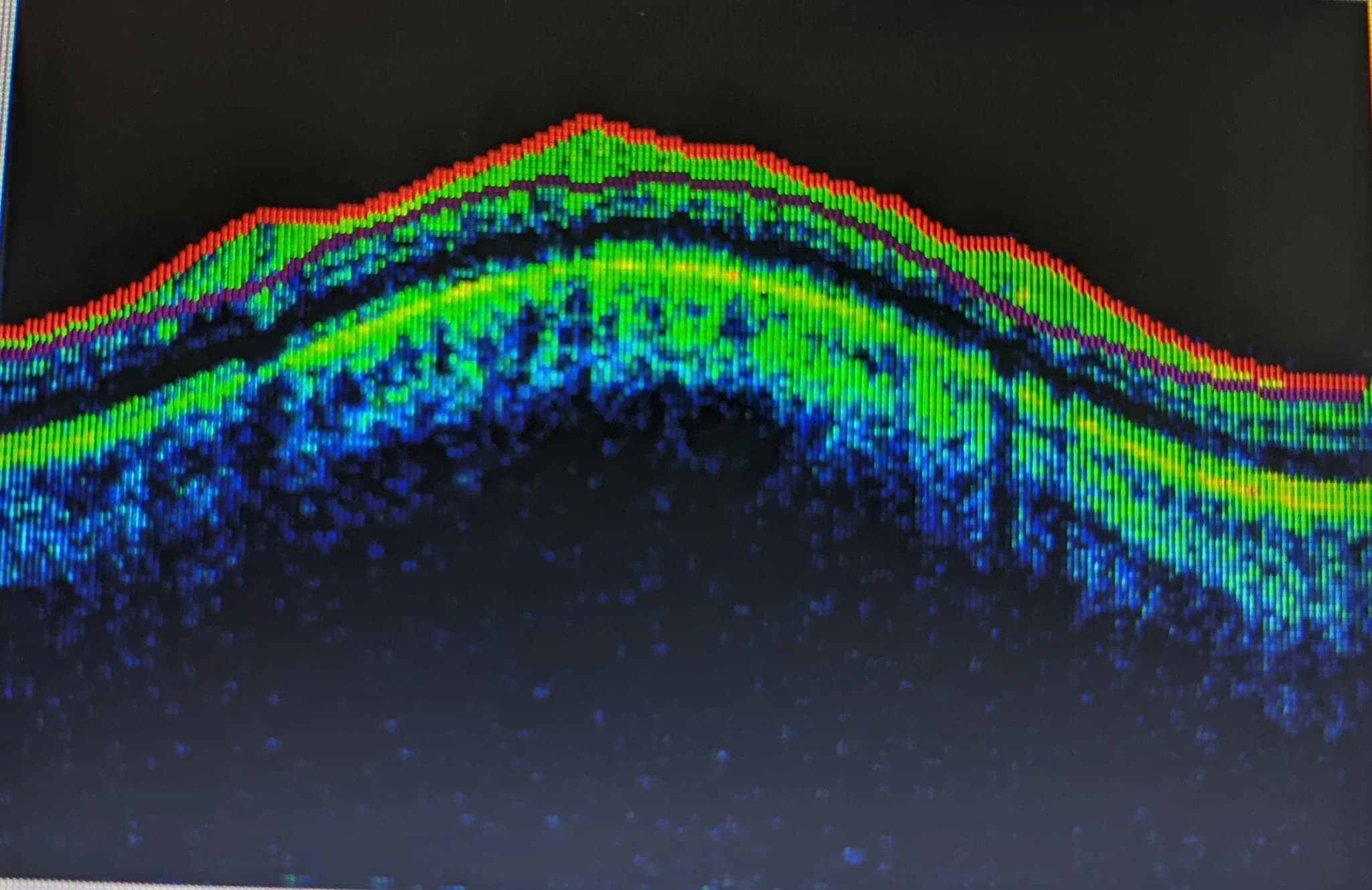 OCT cross-sectional image showing detailed retinal layers in color